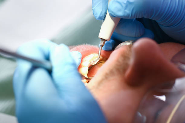 Best Pediatric Emergency Dentist in Lebanon Junction, KY